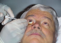 Eye Injection